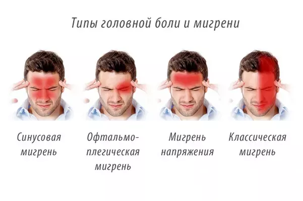 типы головной боли