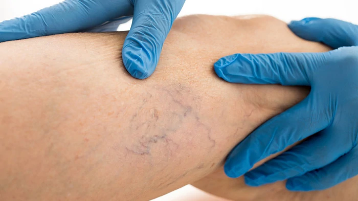 cудинний хірург